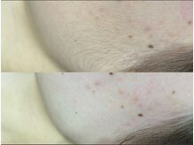 [ツヤ肌に♪]フルフェイスWAX