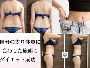 アール シュシュ(R.chouchou)の写真/痩せる為のスリーステップ【熱汗痩身】で衝撃サイズダウン！120分しっかり施術で理想のスッキリボディへ