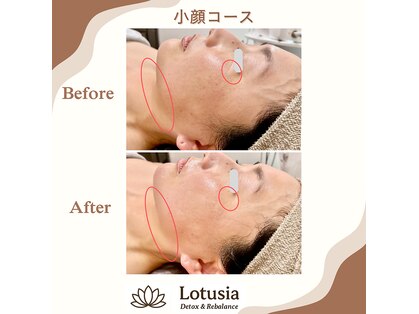 ルトゥーシア(Lotusia)の写真