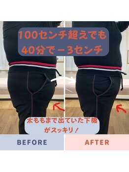 バンビ ビューティーラボ/下腹に変化あり