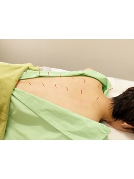 腰のつらさを改善したい