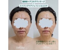 ネマウム(nemaum)/脳美容エイジングケアエステ