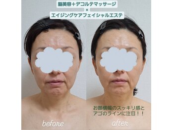 ネマウム(nemaum)/脳美容エイジングケアエステ