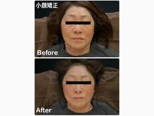 ビプラス(BePlus)の雰囲気（芸能人御用達、バランスも整えるソフトタッチの小顔矯正技術）