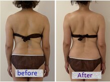 ナチューラ(Natura)/その日のうちにやせて帰れる店