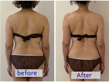 ナチューラ(Natura)/その日のうちにやせて帰れる店