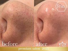 フェイン 青山店(fein.)