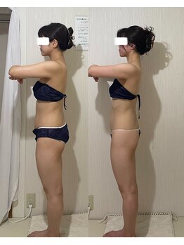 ウツク(utuku)/ブライダル痩身/三条市/見附市/