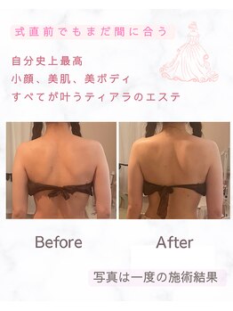 ティアラ(Tiara)/