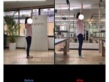 ラ ピラティス 静岡店(La pilates)/beforeafter