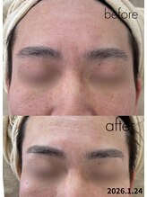 ルポ(Repos)/メンズエステシェービング