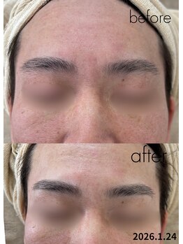 ルポ(Repos)/メンズエステシェービング