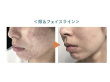 温熱リンパサロン アルビオ(Aluvio)/お肌ケア