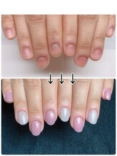 スマイルニコ(smile nico)/深爪矯正　長さ出し有ワンカラー