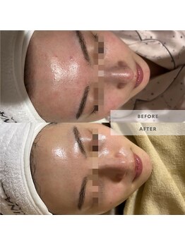 ウルス(ulus)/ハーブリプロ