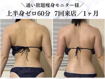 シーフェイス 横浜店(SEE FACE)/上半身ゼロダイエットモニター様