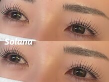 ソラナ(solana)/大人気メーテルロッド