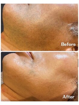 ルタンリッシュオム(Lutan Riche hom)/メンズ脱毛に自信あり!