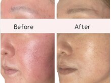 シャムリー(SHAMRY)