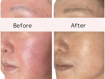 シャムリー(SHAMRY)