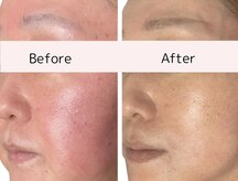 シャムリー(SHAMRY)