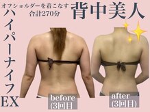 エステサロン ヴリエ 立川店/ハイパーナイフEX計270分施術★