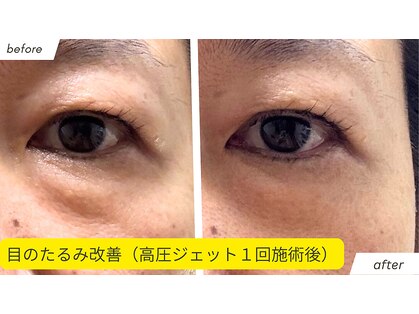 エステサロン プラスエー(+A)の写真