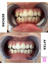 エクシアホワイトニング 王寺店/