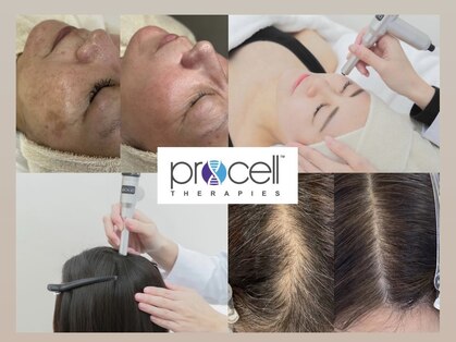 ラヴィ(Ravi)の写真