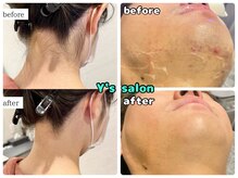 ワイズサロン(Y's salon)