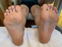 ビサンテ サロン/フットケア,たこ&足裏バランス-4