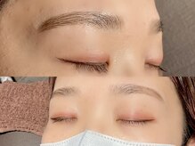 シエル(Ciel by Luxe)/ハリウッドブロウリフト