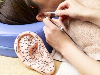 ゆり鍼灸/ダイエットに!効果大