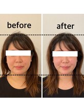 マーキュリー(Mercury)/美容鍼灸+ハーブのお客様