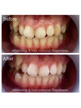 ハピネス 心斎橋アメリカ村本店(Happiness)/