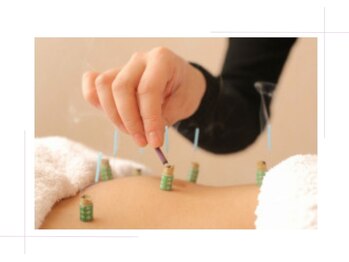 メイロン(meilong)/お灸もあります★