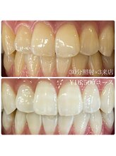 ホワイトニングルーム 川崎店(WhiteningRoom)/ホワイトニング/川崎