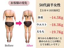 ベルホワイト(Belle White)/【50代前半/3ヶ月の変化】