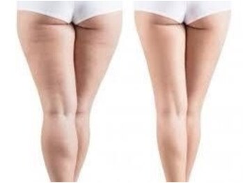 ヨサパーク カラー 小山城南店(YOSA PARK Calla)の写真/【LULUONN×全身リンパマッサージ】リンパを流してからLULUONNで施術効果UP！全国痩身人気サロン♪