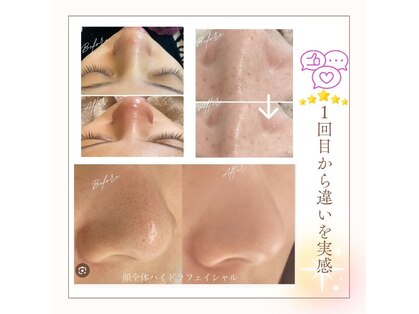 クレッセント(Crescent)の写真