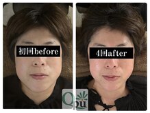 キュープ 富士店(Qpu)の雰囲気(寝落ちできるほど気持ちのいい唯一無二の施術です!小顔/富士市)