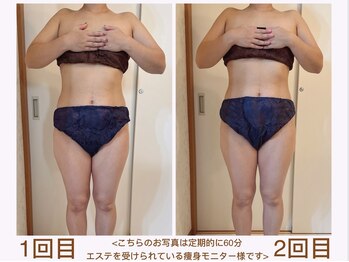 ルル リラクゼーション(RURU Relaxation)/ダイエット/ボディライン