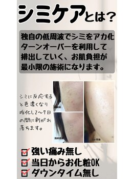 コリー(Kolly)/シミケアとは？