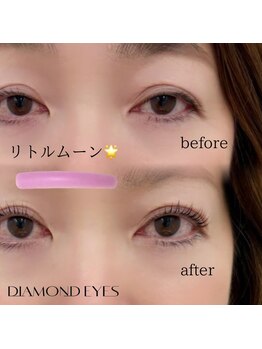 ダイヤモンドアイズ 調布店(DIAMOND EYES)/リトルムーン まつぱ