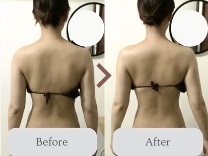 エミィ(emmy)の写真