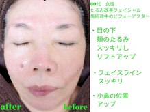 ビューティサロン オハナ(ohana)/フェイシャルのビフォーアフター