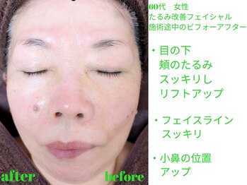 ビューティサロン オハナ(ohana)/フェイシャルのビフォーアフター