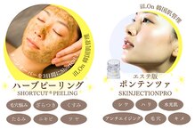 アルッカ(Arukka)