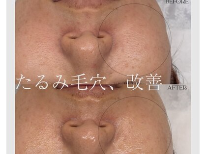 リレアボーテ(RILEA BEAUTE)の写真
