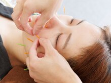 楽楽鍼灸院 整骨院の雰囲気(むくみ/たるみ/ほうれい線/くすみが気になる方に人気の美容鍼)